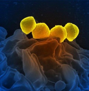 The fight against bacteria that cause strep throat and other illnesses could get help from an HIV drug. Credit: National Institute of Allergy and Infectious Diseases 